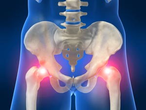 Hip Pain Common Causes