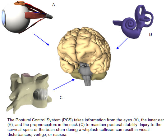 Dizziness and auto accidents